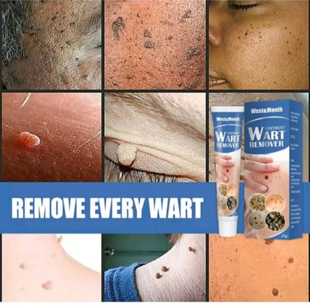 HỘP KEM BÔI TRỊ HẾT MỤN CÓC MỤN THỊT NÚT RUỒI DA THÂM SẠM