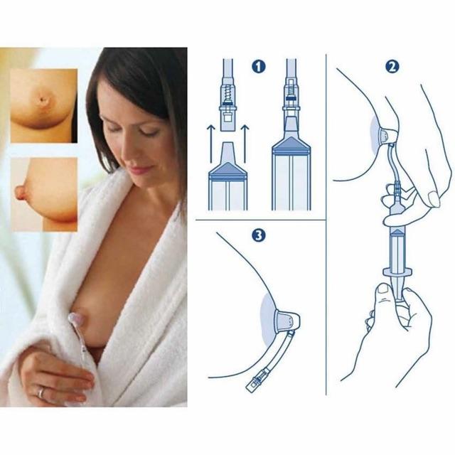 Dụng cụ hút núm ti - Kéo dài đầu ngực