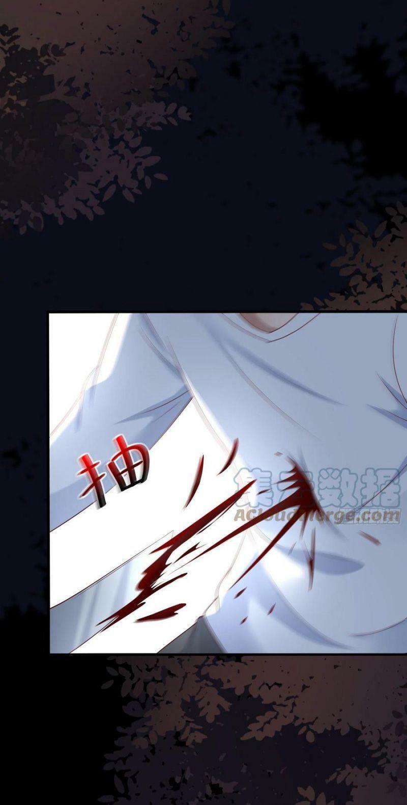 vua đầu tư mạnh nhất chapter 71 25