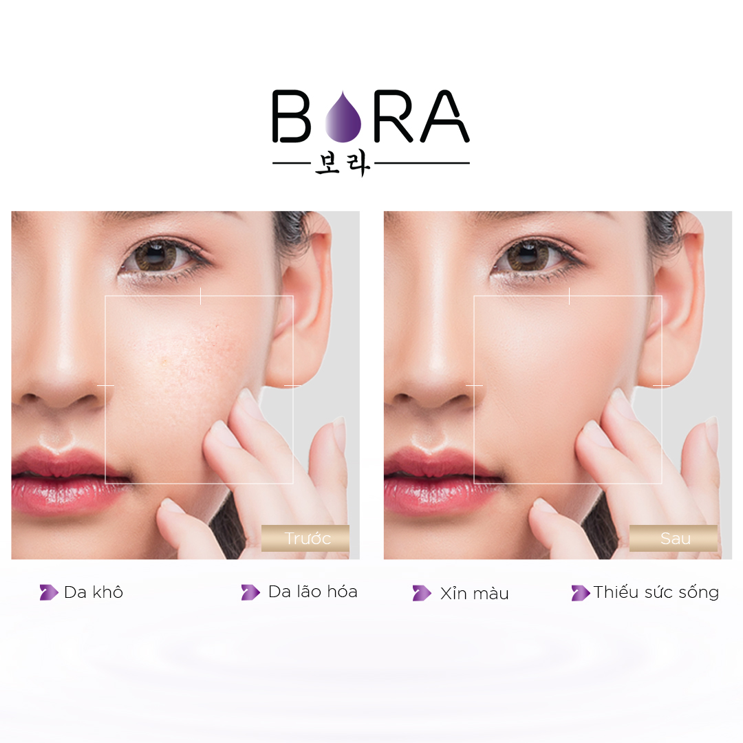 Tinh chất ngăn ngừa mụn dưỡng ẩm cho da Bora AHA 8% Serum lọ 30ml