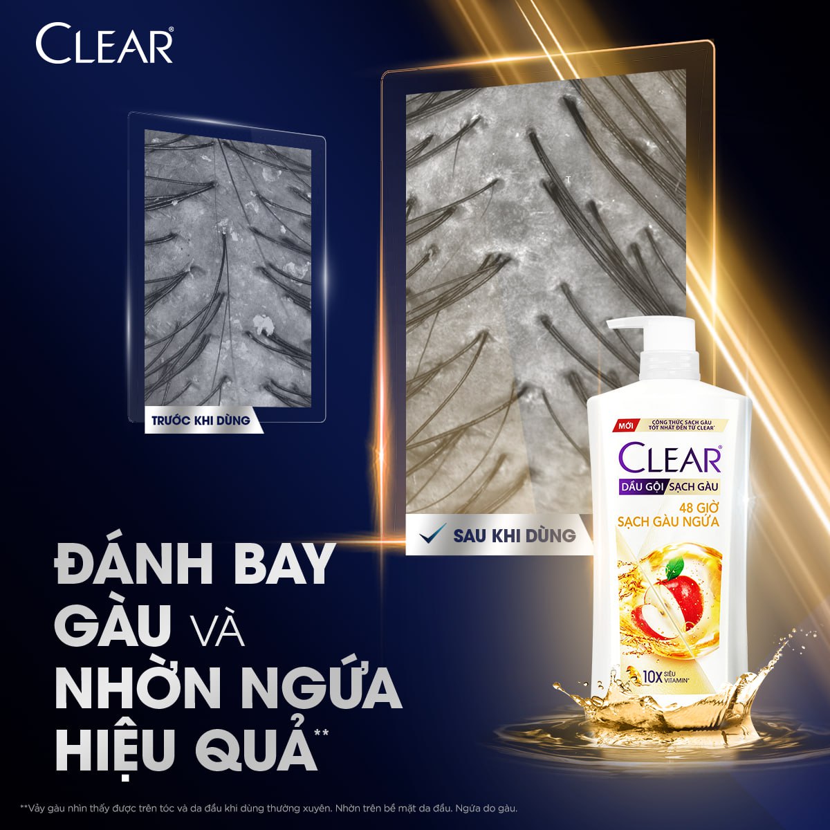 Dầu Gội Clear Thảo Dược Nuôi Dưỡng Da Đầu Từ Gốc, Sạch Gàu Và Giảm Gãy Rụng 630g - Gừng &amp; Hoa Cúc