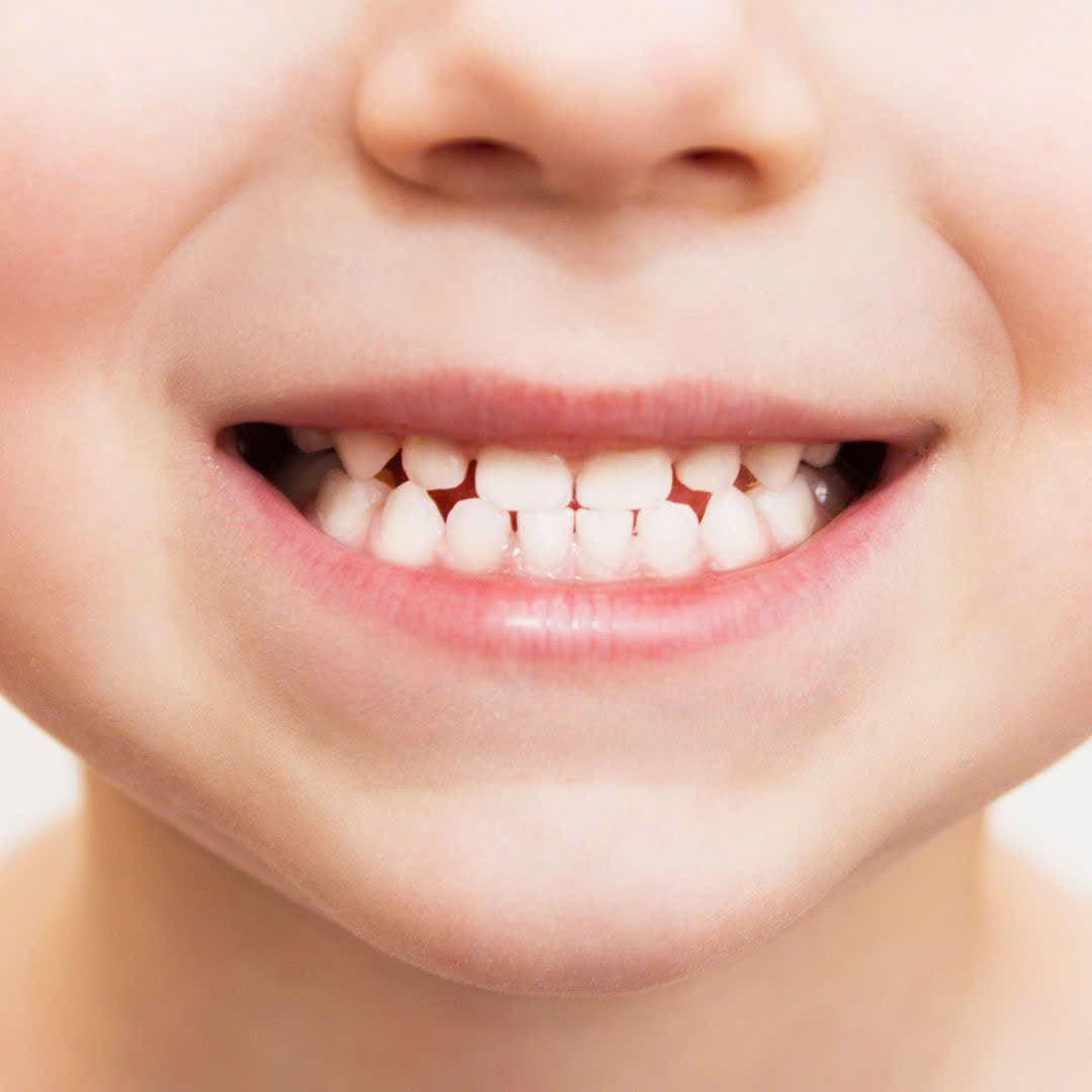 Set 2 Cây Bàn Chải Đánh Răng Cho Bé Từ 04~09 Tuổi  RDK – 280Y Màu Trắng Kỳ Lân