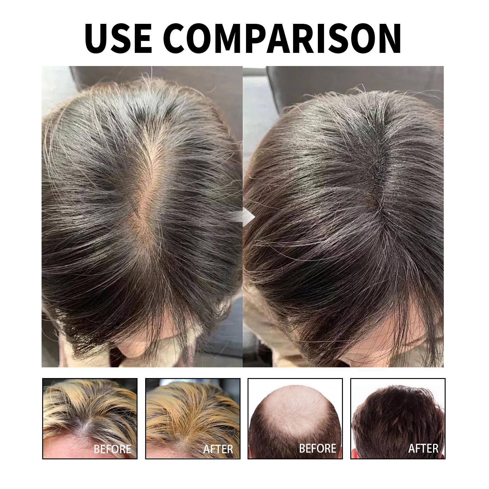 Jaysuing 60ml Hair Loss Solution Serum Natural Essence Prevent Hair Loss Stimulate Scalp Plumping Up
