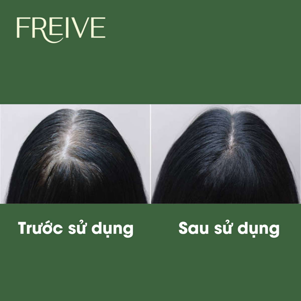 Xịt dưỡng tóc thảo dược Freive giúp mọc tóc mượt tóc đen tóc và thơm tóc 100ml