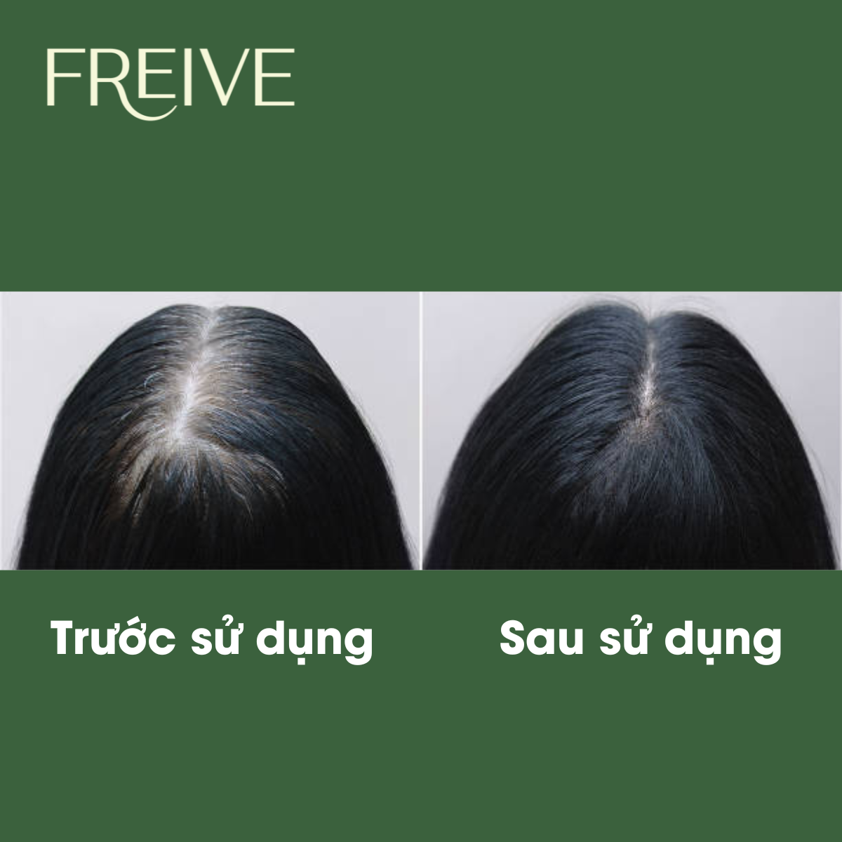 Kem ủ tóc thảo dược Freive phục hồi hư tổn mọc tóc mượt tóc giúp đen tóc 200ml