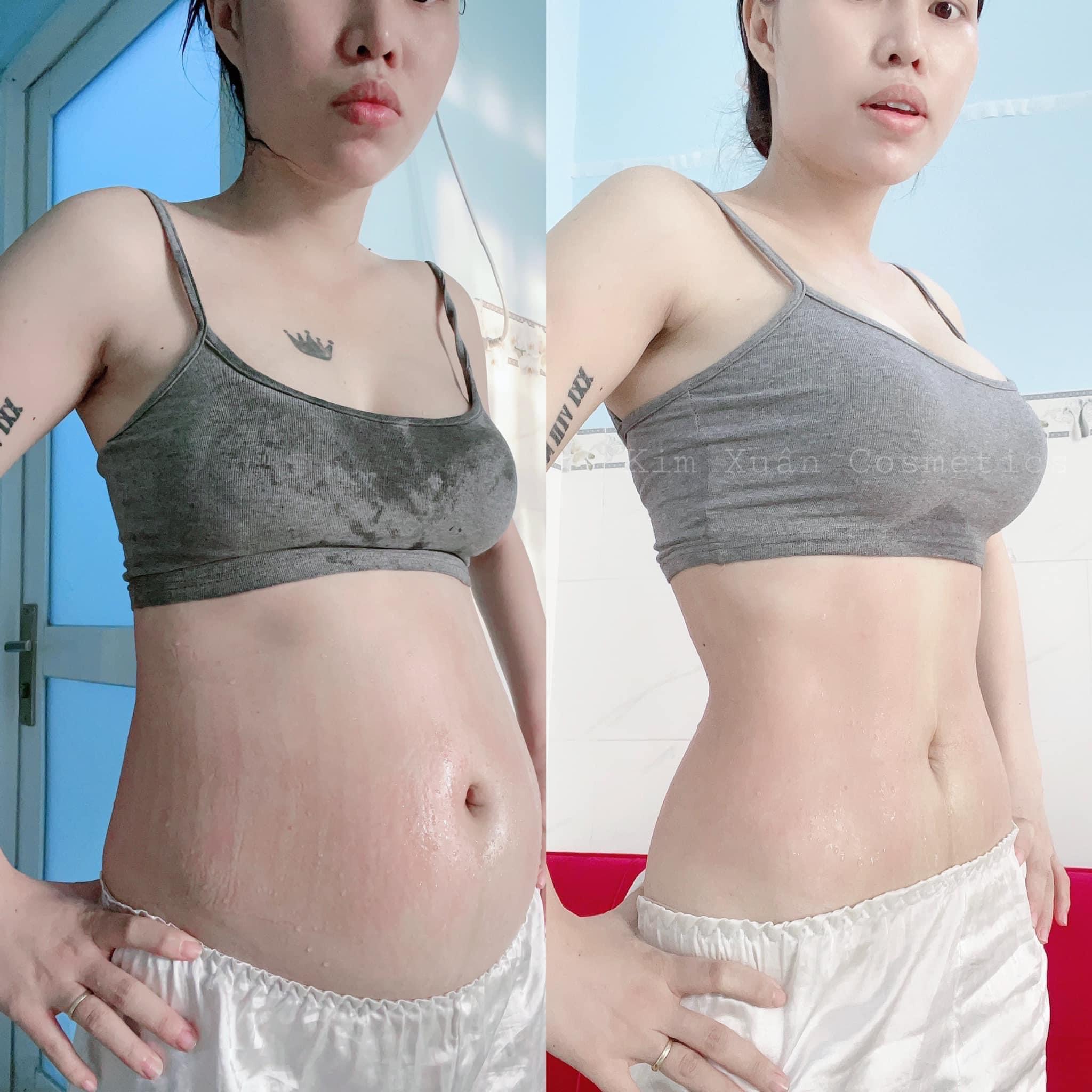 BỘ Ủ NÓNG TAN MỠ SLIMMING BODY SBII .