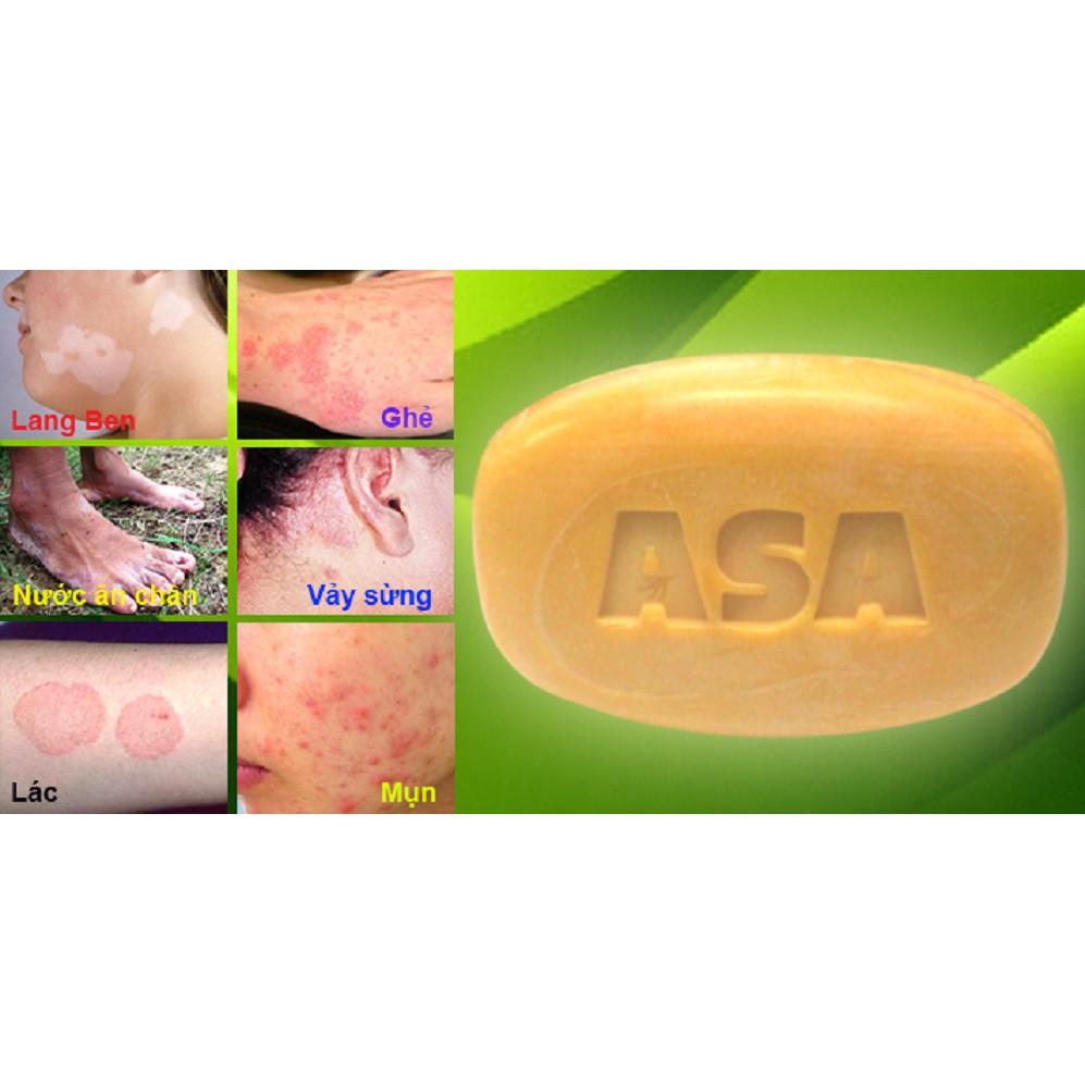 Combo 2 Hộp Xà phòng tắm ASA - ngừa mụn - lác - lang ben - nấm da - Hộp 120g gồm 4 cục nhỏ