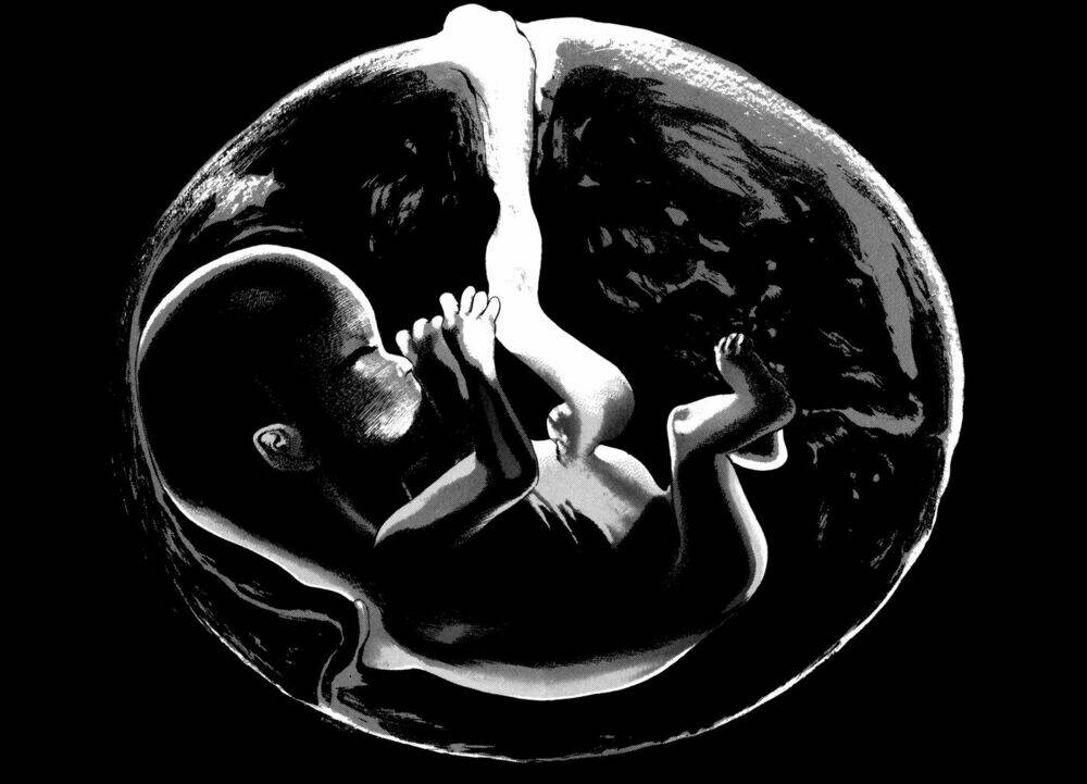 homunculus chapter 86 19