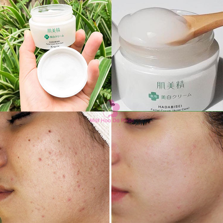 Kem Dưỡng Ẩm Ngăn Ngừa Mụn Kracie Hadabisei Facial Cream Acne Care 50g