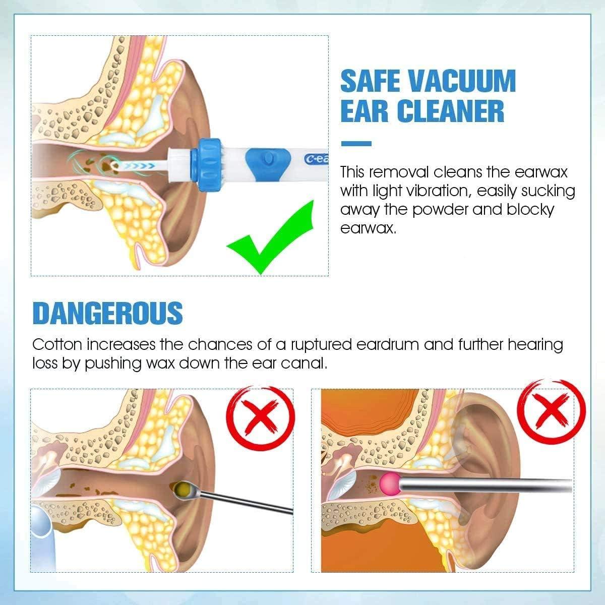 Dụng cụ làm sạch tai bằng điện Bộ dụng cụ lấy ráy tai Dụng cụ lấy ráy tai Dụng cụ lấy ráy tai Dụng cụ lấy ráy tai Dụng cụ lấy ráy tai Bộ dụng cụ làm sạch tai