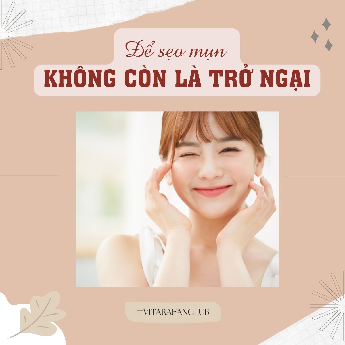 Kem dưỡng ẩm Vitara - E Cream se khít lỗ chân lông, mờ sẹo mụn, cải thiện độ đàn hồi cho da 25g