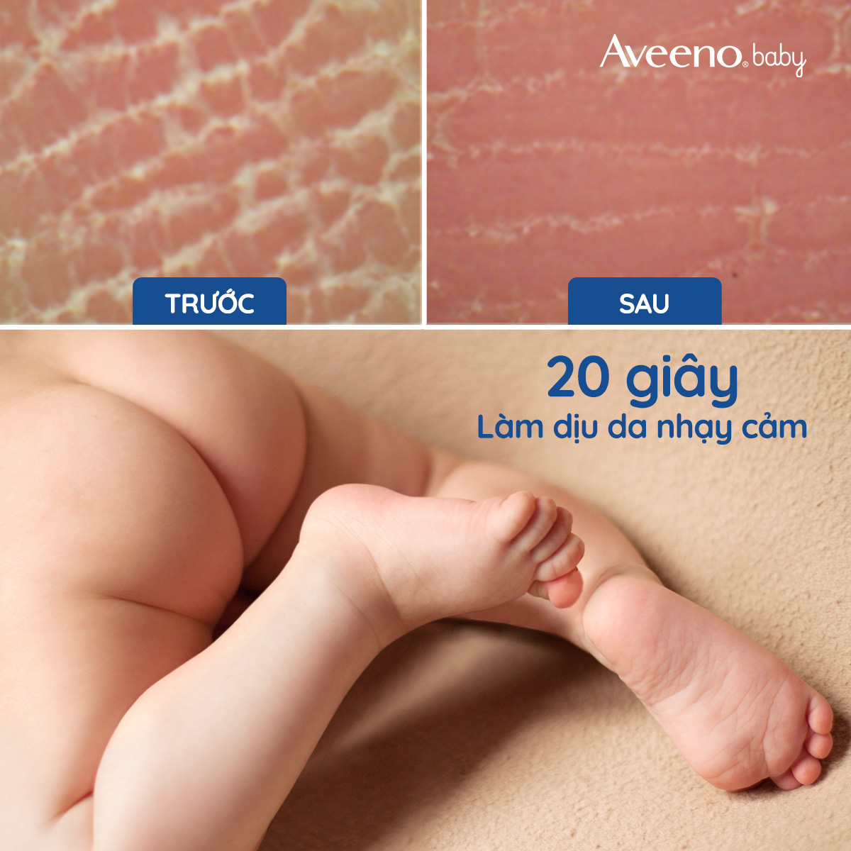 Kem dưỡng Aveeno Baby cho da khô và nhạy cảm 227g - 101016747
