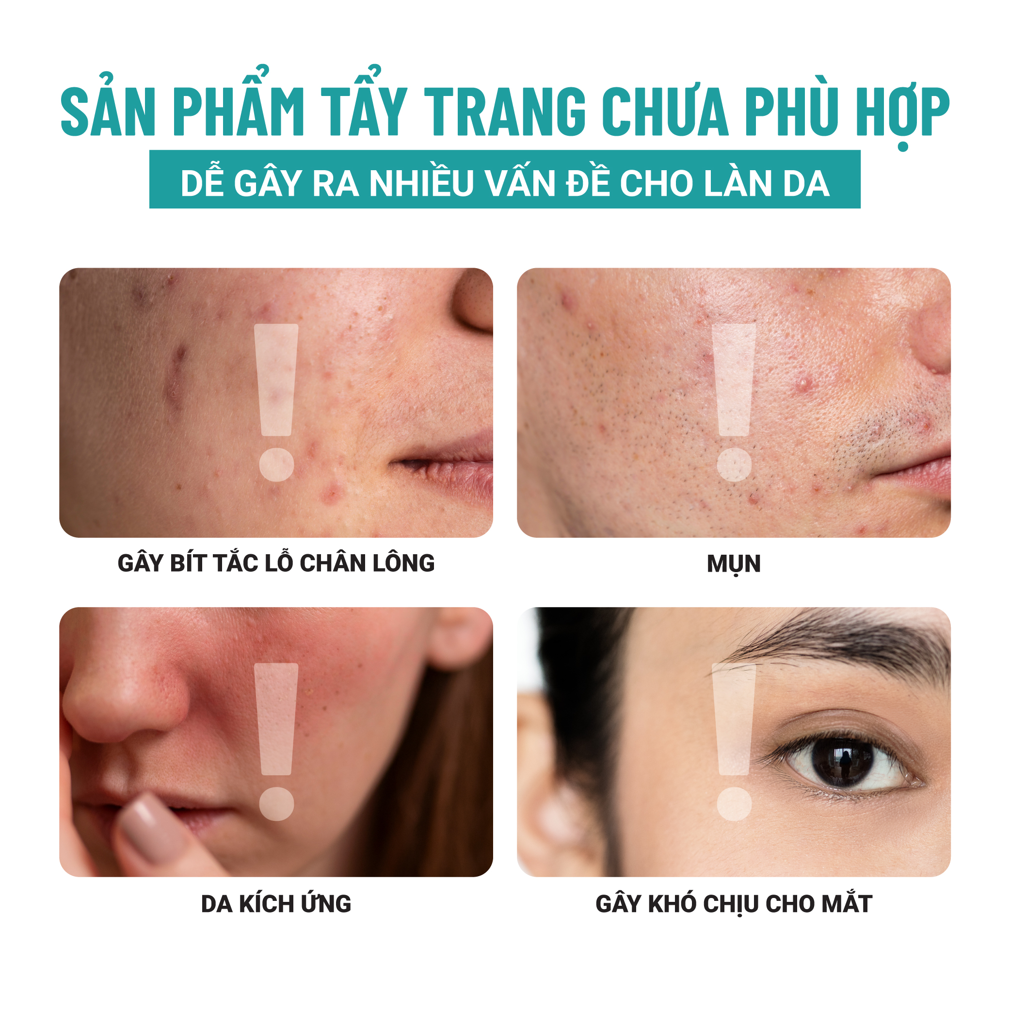 Nước Tẩy Trang Thuần Chay Nha Đam Xương Rồng Heebee’s Sạch Sâu, Dịu Nhẹ, Ngừa Mụn, Cho Da Nhạy Cảm, Không Khô Da 110ml