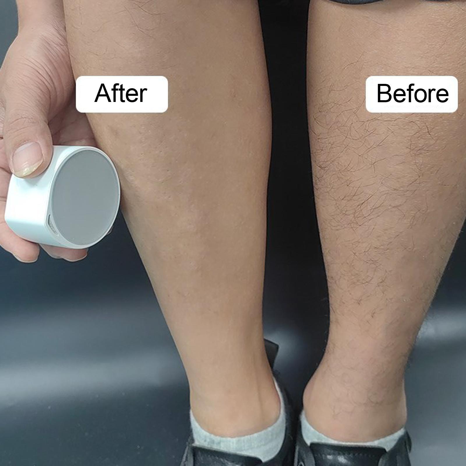 Physical Hair Removal Depilation Depilation Tool Reusable for Chest Leg Body