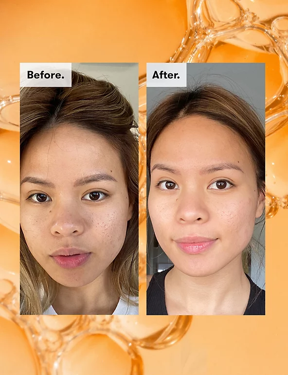 Toner tẩy tế bào chết Ren Ready Steady Glow Daily Aha Tonic 250ml