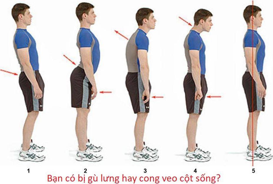 Đai Chống Gù Lưng Cho Người Lớn Và Trẻ Em