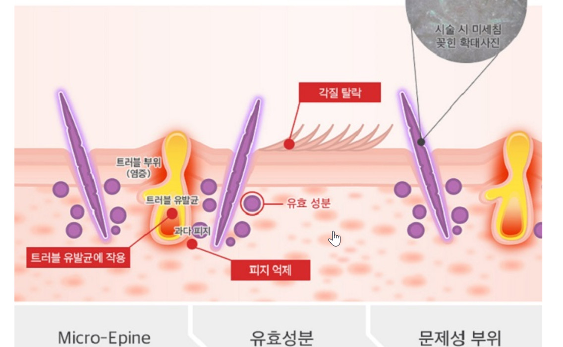 Siêu Vi Kim Lafine Bio Fillertox Ampoule