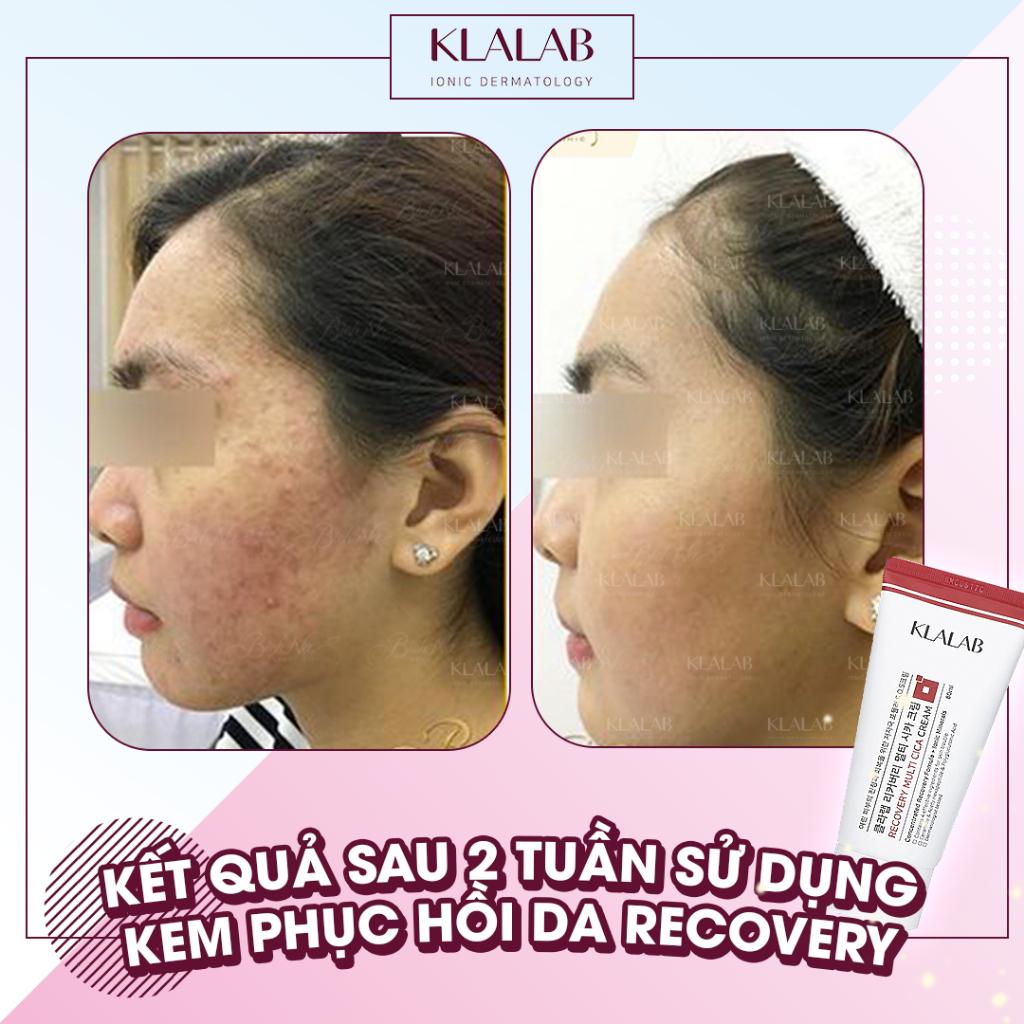 Kem Phục Hồi Da KLALAB Recovery Mutil CiCa Cream 80ml - K2V Shop