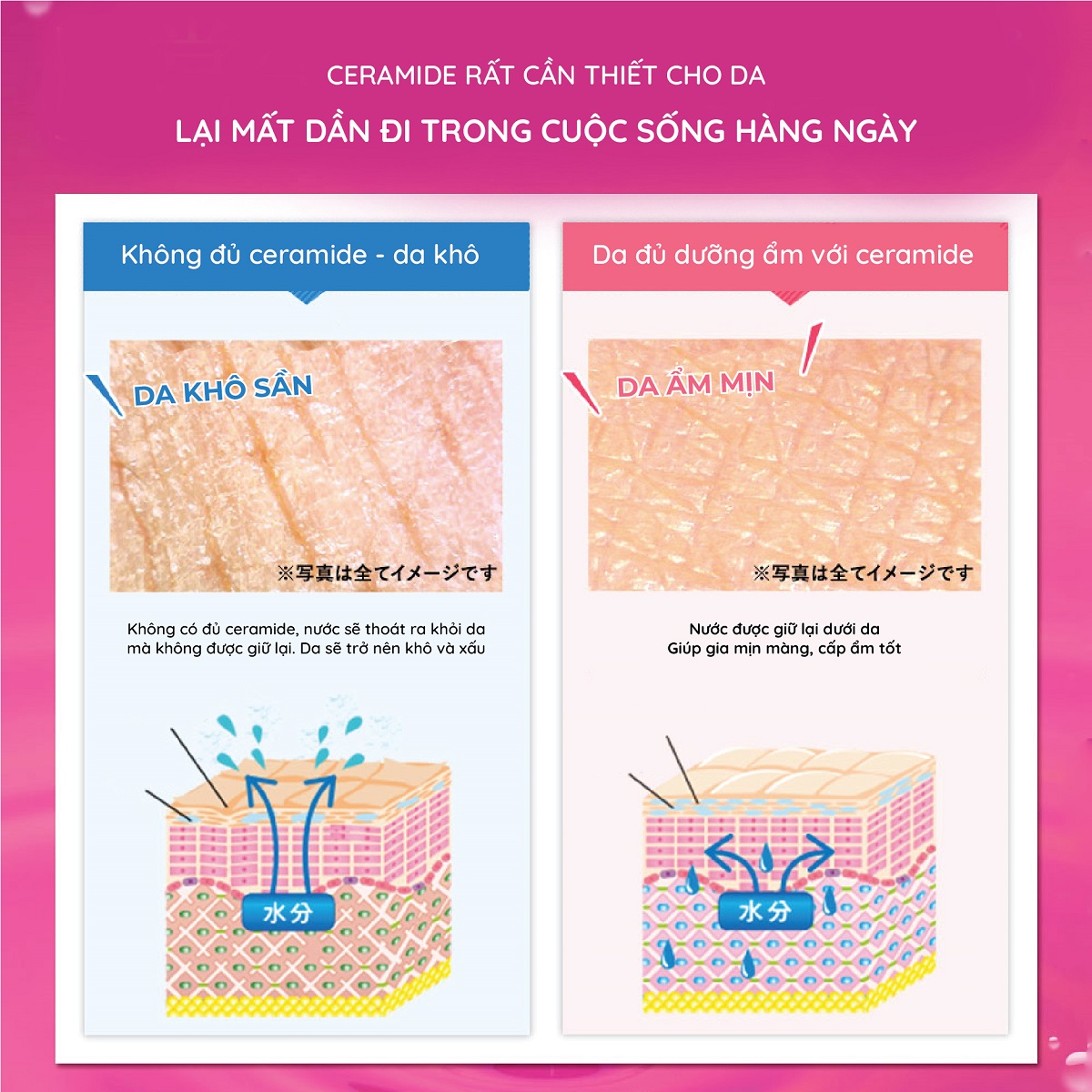 Combo 10 hộp thạch collagen Aishitoto jelly Nhật Bản ceramide vị xoài