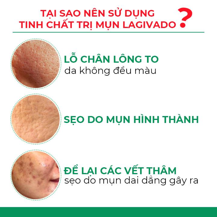 Tinh chất serum dưỡng da Hàn Quốc Lagivado giảm thâm, mờ sẹo, se khít lỗ chân lông Dr. ATreat Serum 30 ml