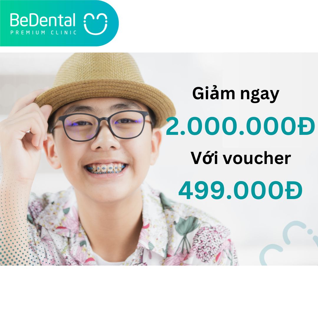 Voucher Niềng răng (trị giá 2 triệu đồng) - Nha khoa BeDental - 5 chi nhánh