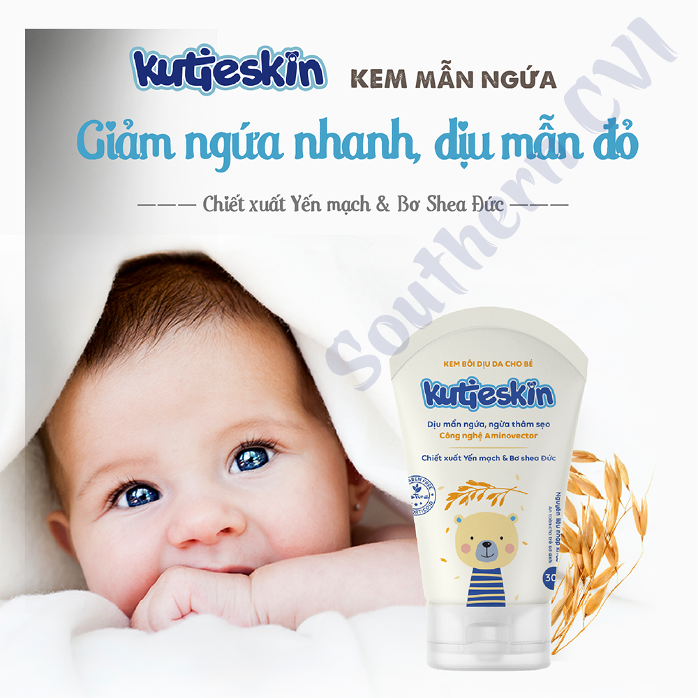 Kutieskin 30G - Kem Mẩn Ngứa, Hăm Tã Cho Bé