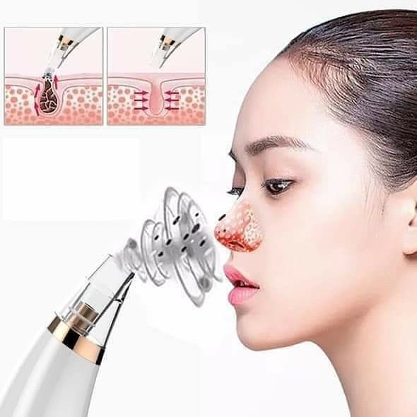 Máy hút mụn đầu đen mini cầm tay siêu mạnh ,kèm 6 đầu hút tùy chỉnh làm sạch lỗ chân lông