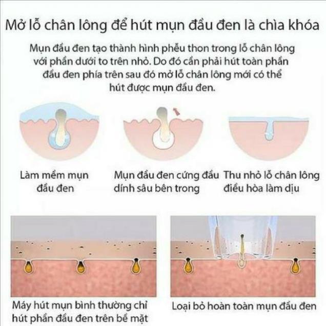 Máy hút mụn trứng cá, mụn đầu đen cao cấp