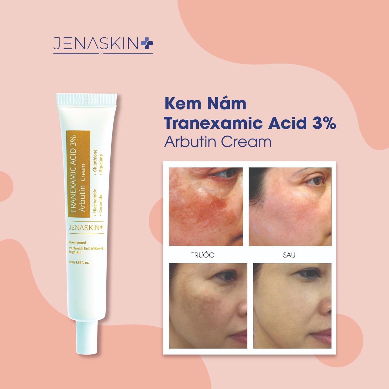 Kem Nám Dưỡng Trắng Jenaskin Tranexamic 3% Nám 50ml - Kem nám dưỡng trắng da, mờ nám, tàn nhang, tái tạo phục hồi da