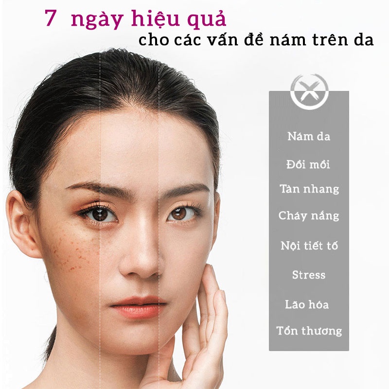 Kem Dưỡng Trắng Da - Ngừa Nám - Giảm Nhăn - Giữ ẩm &amp; Se Khít Lỗ Chân Lông 10 IN 1 OLY HT CHÍNH HÃNG 35G LPK