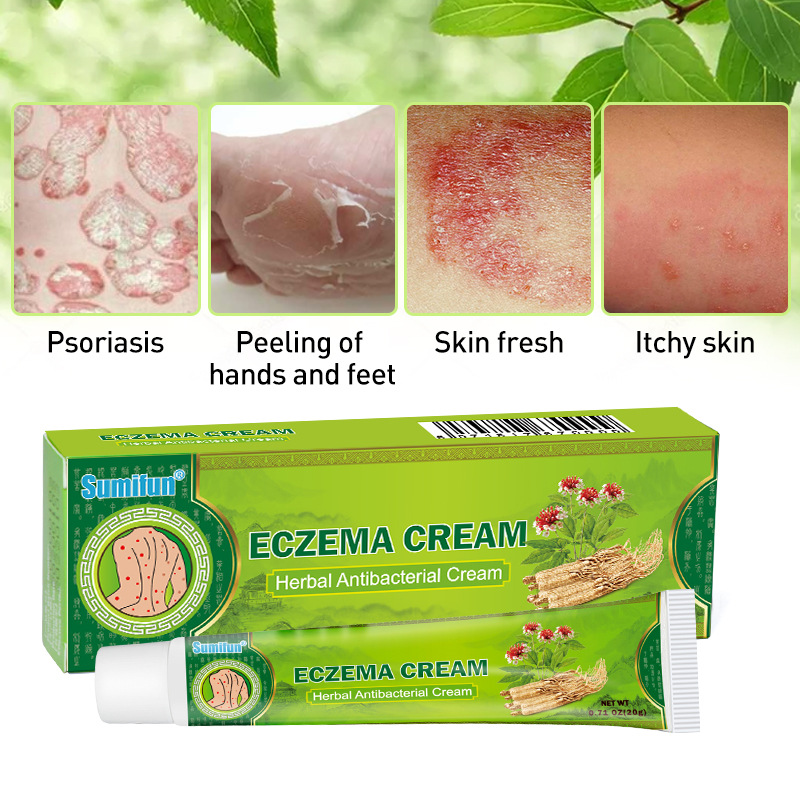 Kem bôi Eczema, chàm khô, chàm nước, ghẻ nước, thành phần thảo dược an toàn tuyệt đối