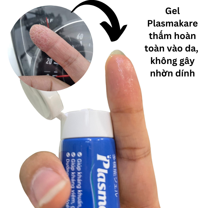 Combo 3 lọ Kem bôi da á sừng Plasmakare No5, phục hồi làn da nứt nẻ bong tróc,á sừng da tay, da đầu, gót chân,toàn thân, không cort