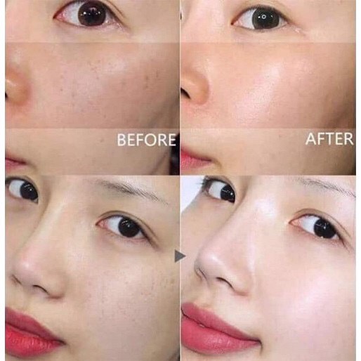 Serum dưỡng trắng, giảm thâm nám DONGSUNG RANNCE C-Serum 45ml