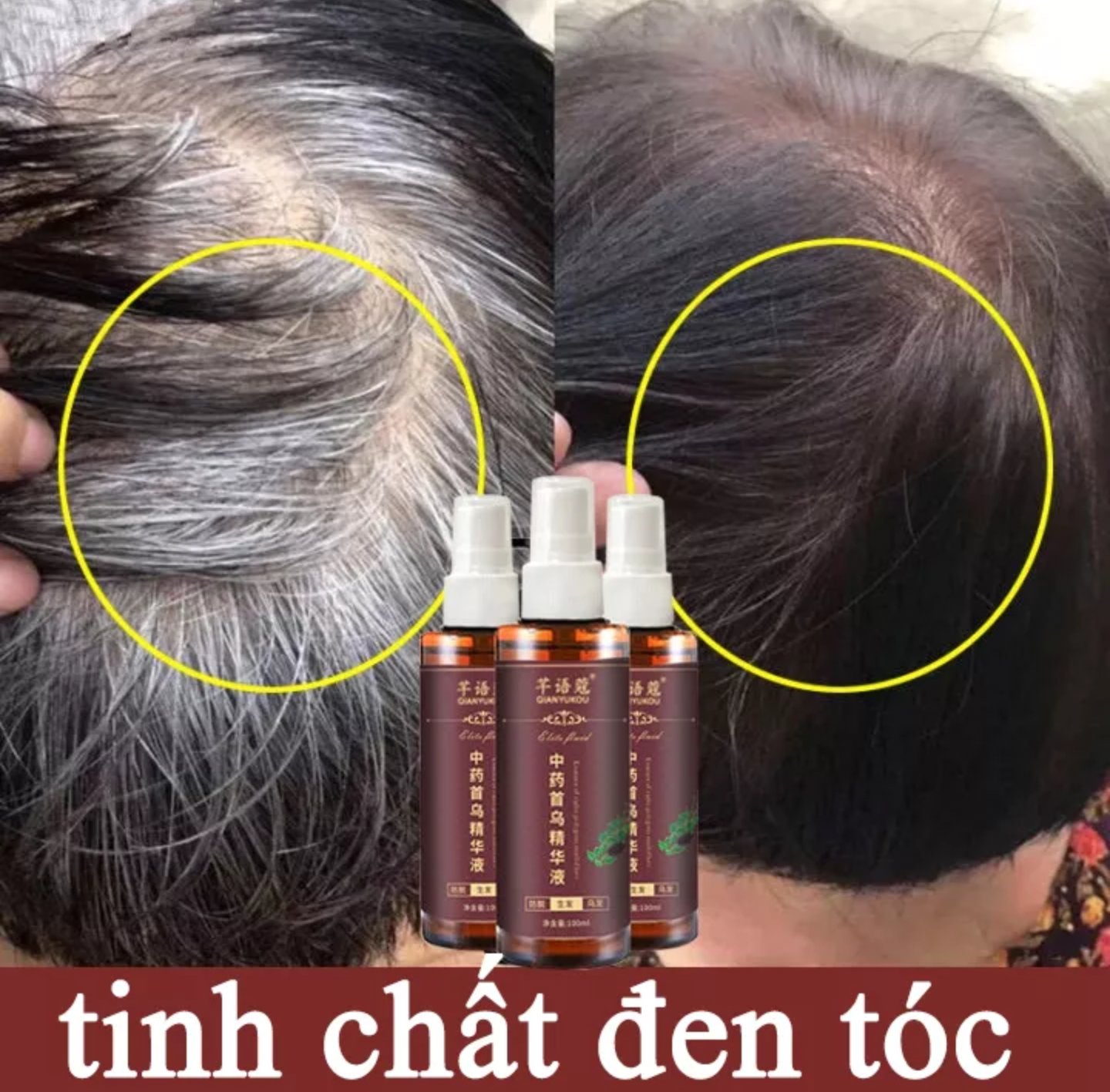 CHAI XỊT ĐEN TÓC DƯỠNG TÓC TÓC TRẮNG THÀNH TÓC ĐEN ĐẸP CAM KẾT HIỆU QUẢ