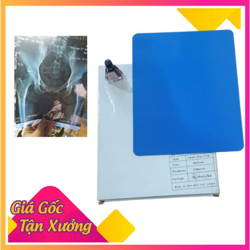 phim x-quang Blue, phim phun 8x10inch 1h 100 tấm