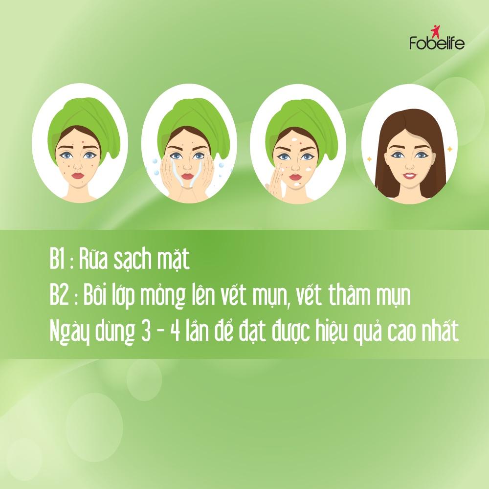 Kem Bôi Mờ Thâm Do Mụn Fobe Acne- tuýp 15g