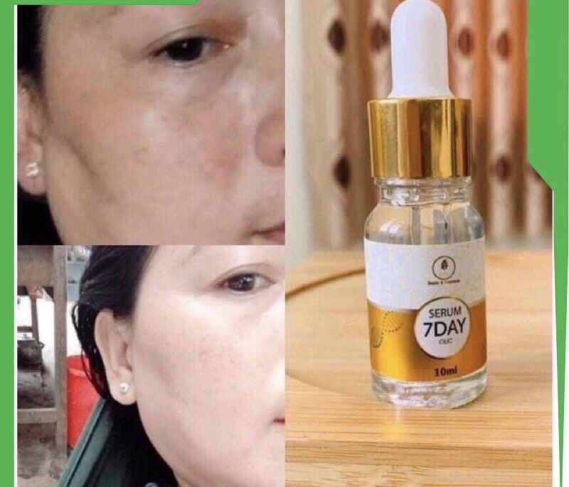 (Sỉ 4) Serum7 Day OlicVàng 10ml SerumHuyếtThanhTruyềnTrắng Xoá Nhắn, TrẻHoá Da