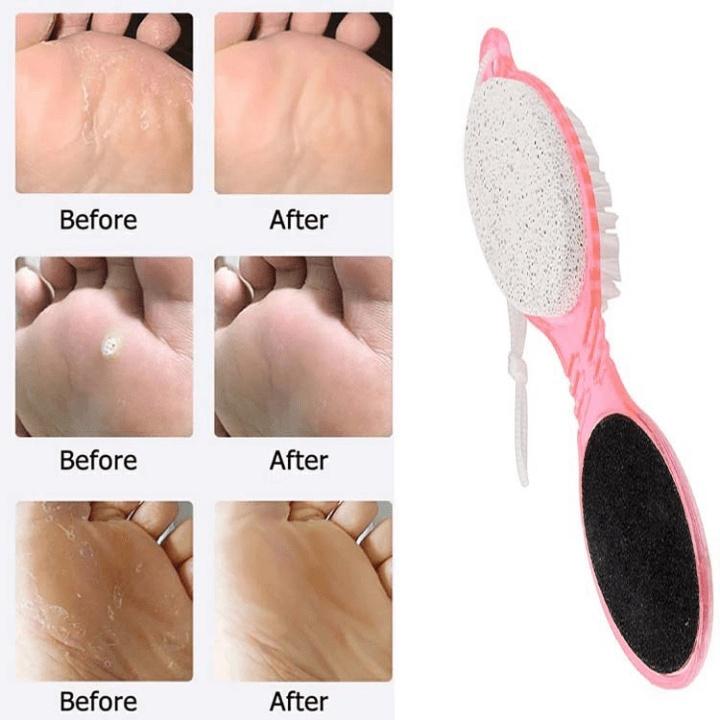 Dụng Cụ Chà Gót Chân Siêu Tốc 4in1