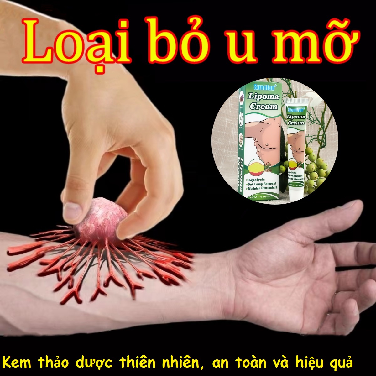 Kem bôi u bướu mỡ, thành phần thảo dược tự nhiên, an toàn tuyệt đối