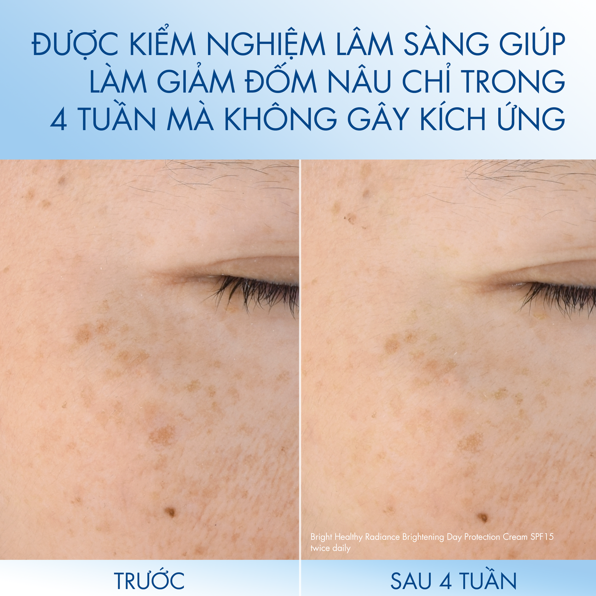 Kem dưỡng ẩm làm sáng da ban đêm Cetaphil Bright Healthy Radiance Night Comfort Cream 50g