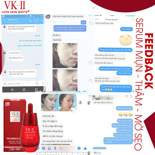 Serum Ngừa Mụn - Thâm - Mờ Sẹo - Kiểm Soát Nhờn VK II