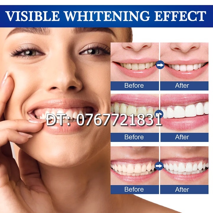 Gel bôi làm trắng, sáng răng, giảm ố vàng, cao răng, giảm hôi miệng và giúp hơi thở thơm tho xuất xứ Nhật Bản – Mã số 1223