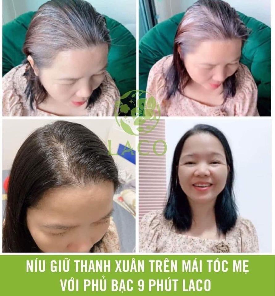 Dầu Gội Phủ Bạc Laco Black Hair - Tóc đen tự tin sau 9 phút