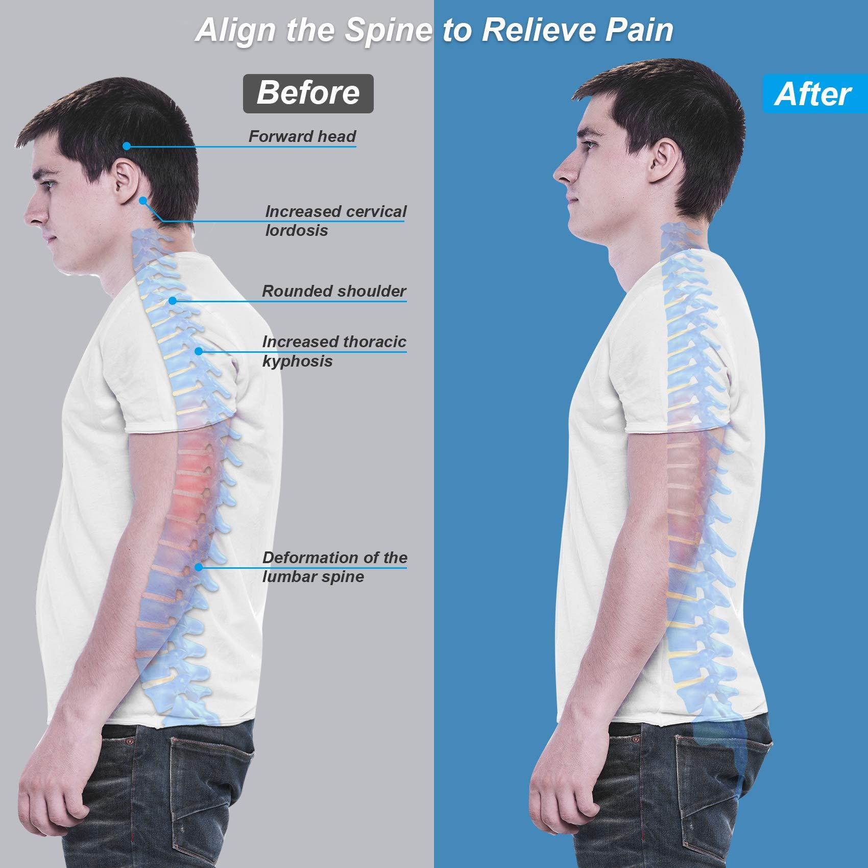 Quay lại thẳng với các thanh chống hỗ trợ Back Băng tư thế sửa chữa cho nam và nữ cải thiện tư thế và giảm đau từ vòng eo vai lưng