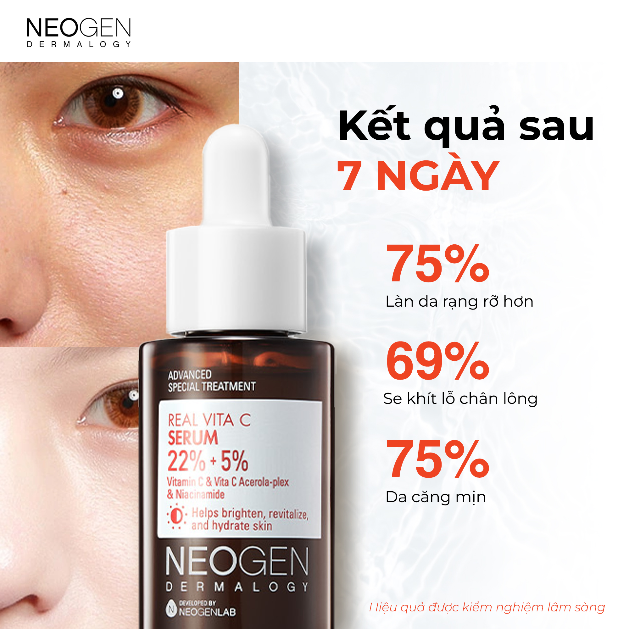 Siêu Tinh Chất Xoá Thâm Dưỡng Trắng Vitamin C SAP Neogen Dermalogy Real Vita Serum 32g