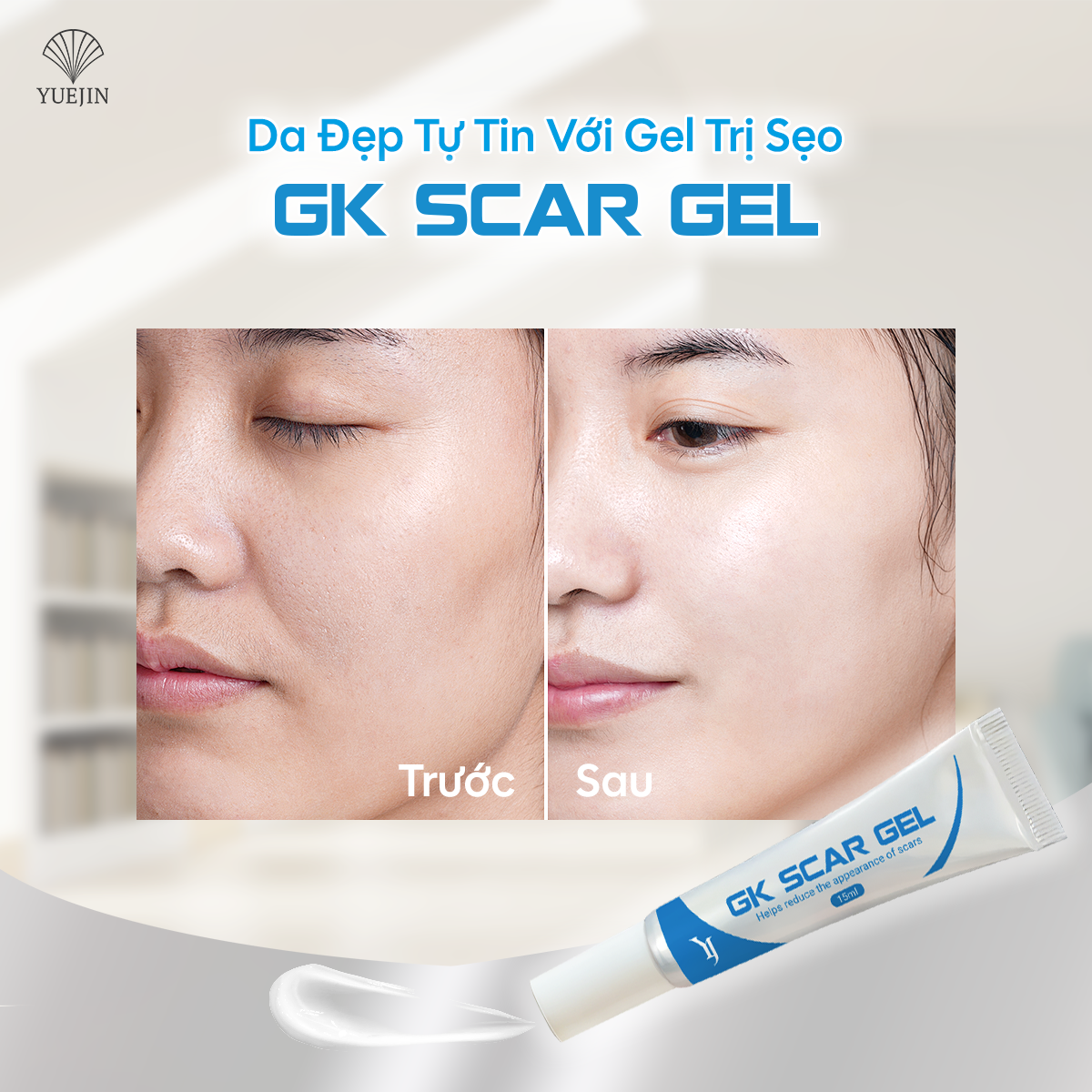 Gel trị sẹo GK SCAR GEL lấp đầy Sẹo Rỗ, Sẹo Lõm, làm phẳng Sẹo Lồi, Sẹo Thâm 15ml của Yuejin