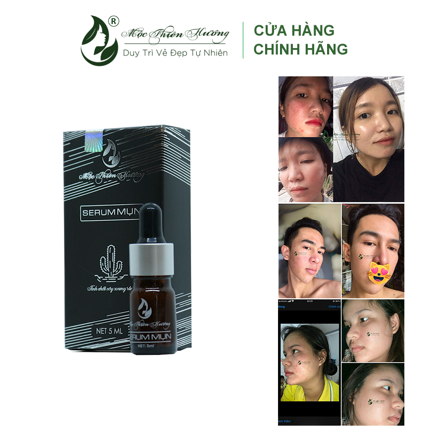 Serum 14 Ngày Hết Mụn Sạch Thâm Không Bong Tróc Không Sưng Đỏ - Mộc Thiên Hương