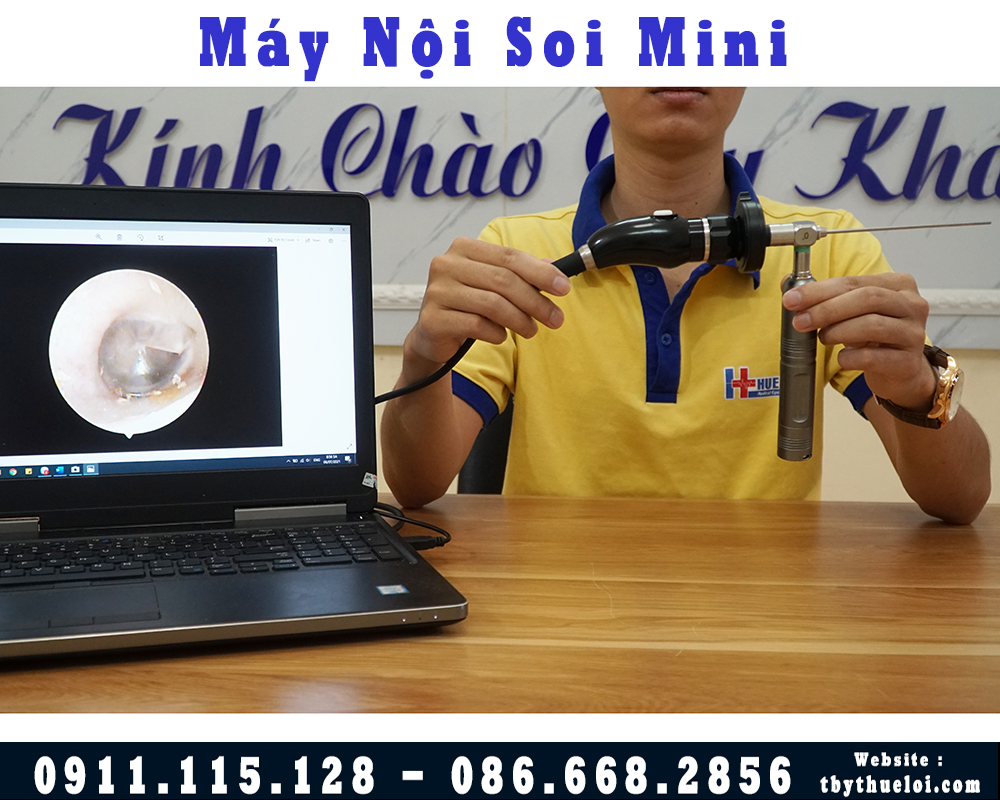Nội Soi Tai Mũi Họng Mini