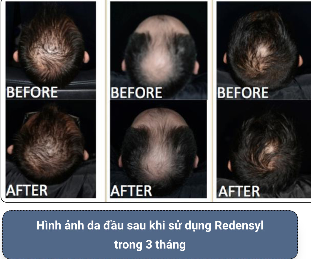 Combo dầu gội, tinh chất Alika for men, hỗ trợ tóc mọc dày, chắc khỏe, nuôi dưỡng chân tóc dày, dài hơn