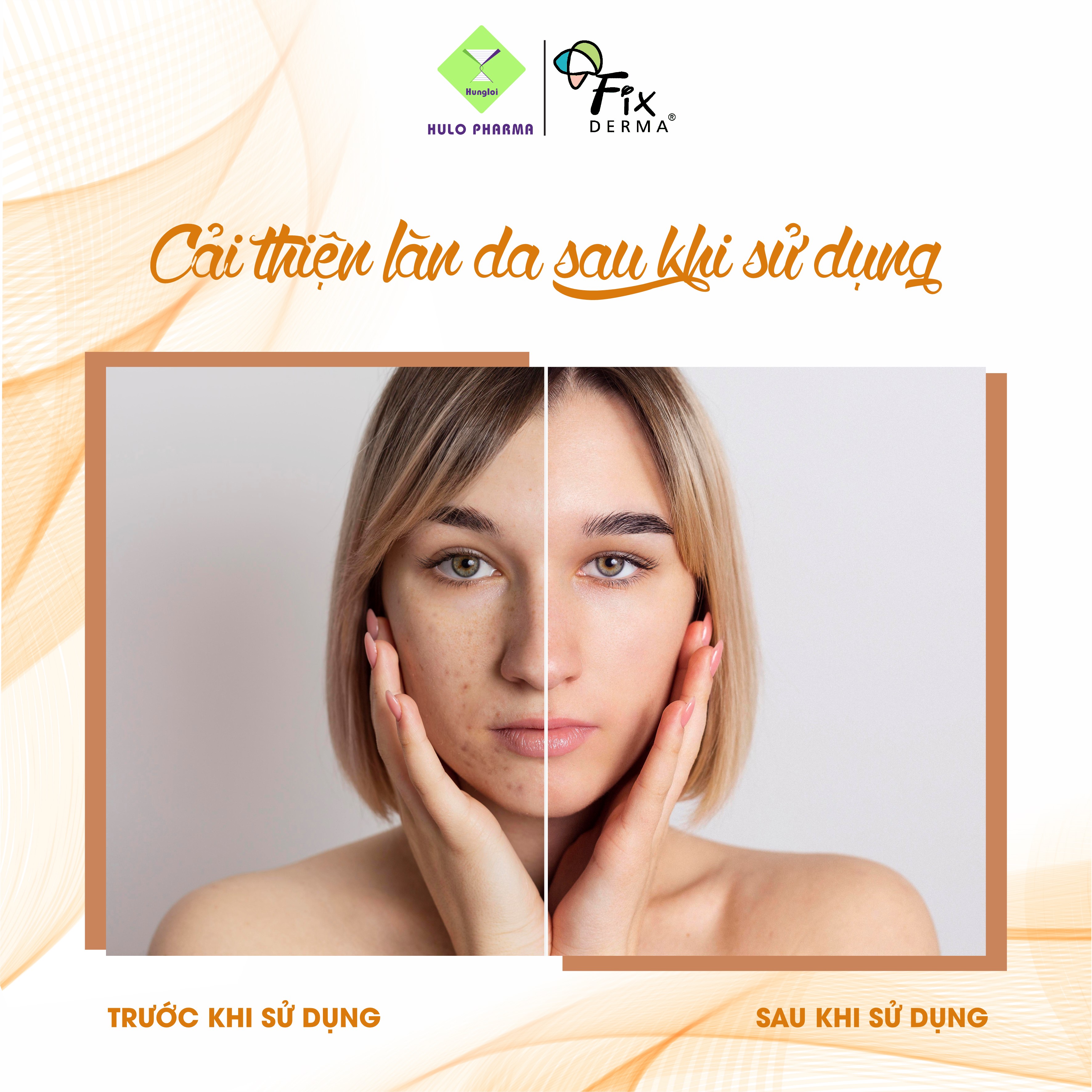 Kem sáng da Fixderma Skarfix Plus Cream (15g)